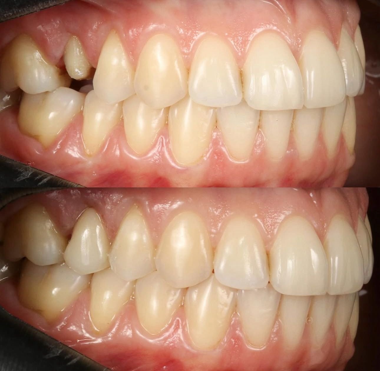 Tratamiento odontología general 2